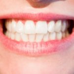 Śliczne zdrowe zęby dodatkowo świetny cudny uśmieszek to powód do zadowolenia.